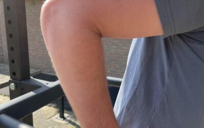 Meneer heeft last van artrose. Fysiotherapeut helpt.